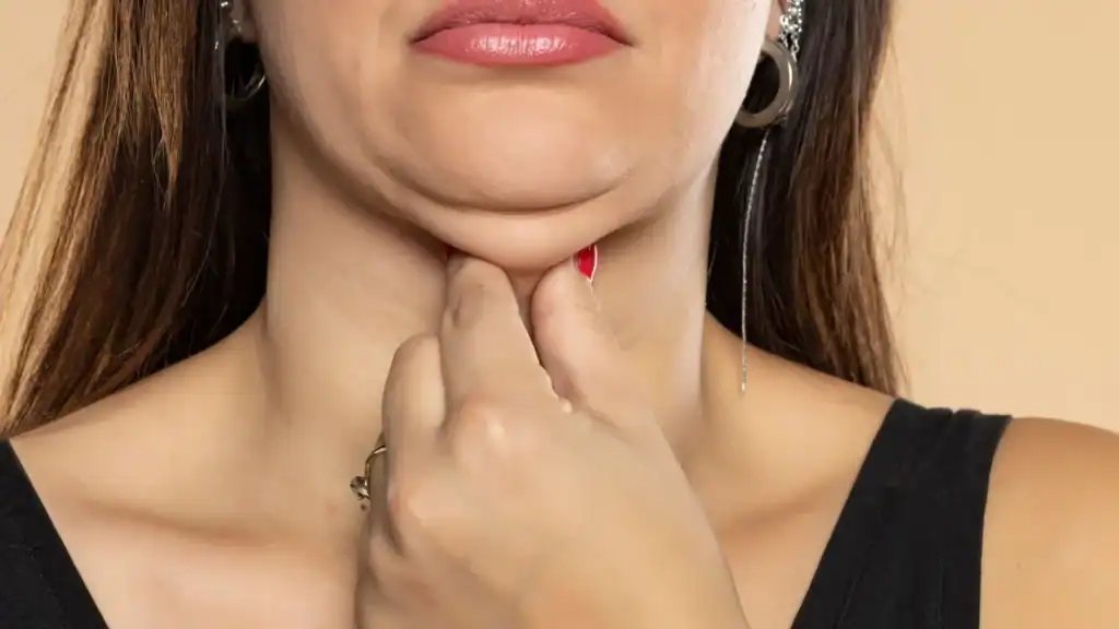 An image of a woman with double chin, sad, worried : Non Surgical Double Chin Removal Treatment in Solihull Lodge, UK
