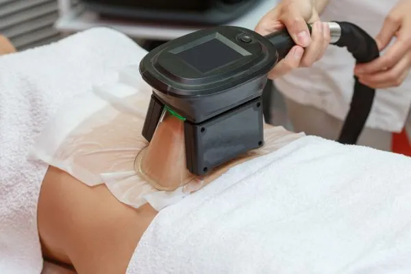 Image of person having fat freezing treatment to help weight gain Solihull Lodge