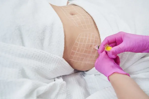 image of fat dissolving injections on love handles to help combat weight gain Solihull Lodge
