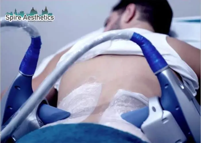 Man having fat freezing treatment done on love handles before a competitions Solihull Lodge to create a sculpted look.